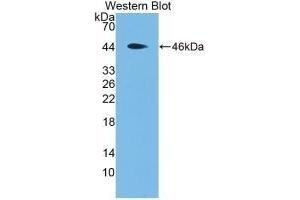 Detection of Recombinant MBP, Rat using Monoclonal Antibody to Major Basic Protein (MBP) (Major Basic Protein antibody  (AA 80-219))