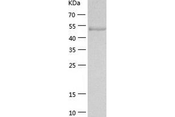 MUSK Protein (AA 22-468) (His tag)