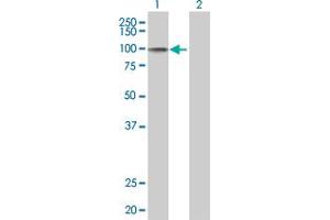 Lane 1: RECK transfected lysate ( 106. (RECK 293T Cell Transient Overexpression Lysate(Denatured))