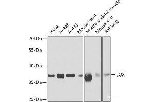 Western blot analysis of extracts of various cell lines using LOX Polyclonal Antibody at dilution of 1:500. (LOX antibody)
