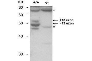 Western Blotting (WB) image for anti-Bridging Integrator 1 (BIN1) antibody (ABIN1043739) (BIN1 antibody)