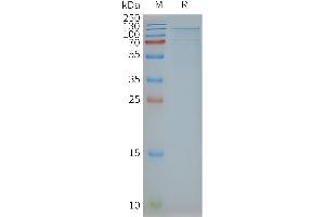 Human TSHR-Nanodisc, Flag Tag on SDS-PAGE (TSH receptor Protein)