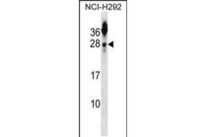 Western blot analysis in NCI-H292 cell line lysates (35ug/lane). (Tetraspanin 2 antibody  (N-Term))