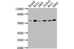 Western Blot Positive WB detected in: HepG2 whole cell lysate, Hela whole cell lysate, 293T whole cell lysate, Jurkat whole cell lysate, Raji whole cell lysate, K562 whole cell lysate All lanes: TRAF2 antibody at 1:1500 Secondary Goat polyclonal to rabbit IgG at 1/50000 dilution Predicted band size: 56, 62, 55, 54 kDa Observed band size: 56 kDa (Recombinant TRAF2 antibody)