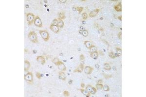 Immunohistochemistry of paraffin-embedded mouse brain using ACOX1 antibody (ABIN5975699) at dilution of 1/100 (40x lens). (ACOX1 antibody)