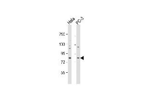 Western Blot at 1:1000 dilution Lane 1: Hela whole cell lysate Lane 2: PC-3 whole cell lysate Lysates/proteins at 20 ug per lane. (KCTD3 antibody  (C-Term))