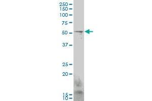 GCM1 monoclonal antibody (M06), clone 3D3. (GCM1 antibody  (AA 108-166))