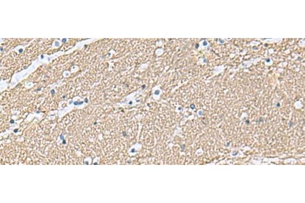 Transgelin 3 antibody