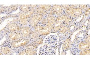 Detection of F12 in Human Kidney Tissue using Polyclonal Antibody to Coagulation Factor XII (F12) (F12 antibody  (AA 400-615))