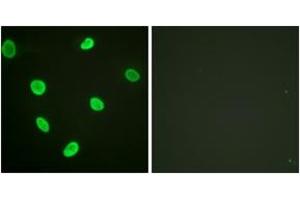 Immunofluorescence (IF) image for anti-Histone H2B (acLys12) antibody (ABIN2890727) (Histone H2B antibody  (acLys12))