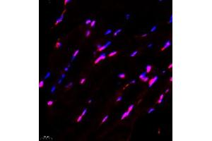 Immunofluorescence of paraffin embedded mouse Skeletal muscle using FUS (ABIN7075919) at dilution of 1:1000 (400x lens) (TLS/FUS antibody)