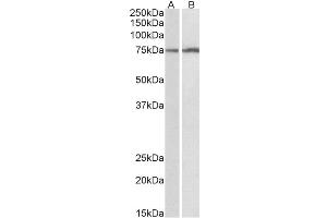 Western Blotting (WB) image for anti-Cytochrome P450, Family 2, Subfamily B, Polypeptide 6 (CYP2B6) (AA 247-259) antibody (ABIN5898850) (CYP2B6 antibody  (AA 247-259))