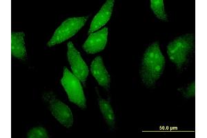 Immunofluorescence of monoclonal antibody to EIF4ENIF1 on HeLa cell. (EIF4ENIF1 antibody  (AA 886-985))