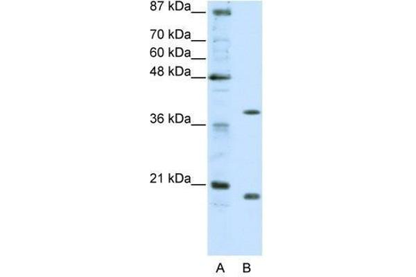 ZNF322A 抗体  (C-Term)