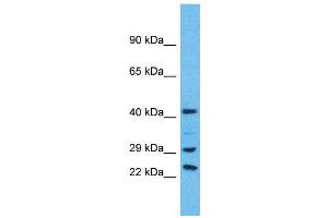 Western Blotting (WB) image for anti-Ubiquitin Specific Peptidase 41 (USP41) (C-Term) antibody (ABIN2791978) (USP41 antibody  (C-Term))