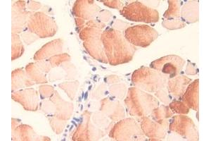 DAB staining on IHC-P; Samples: Mouse Skeletal muscle Tissue (MID1 antibody  (AA 1-212))