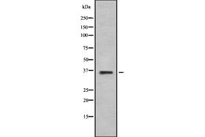 Western blot analysis of AR-beta3 using K562 whole cell lysates (ADRB3 antibody  (Internal Region))