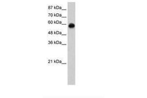 Image no. 2 for anti-Kelch-Like ECH-Associated Protein 1 (KEAP1) (C-Term) antibody (ABIN6736255) (KEAP1 antibody  (C-Term))