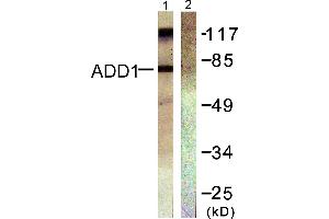 Western blot analysis of extracts from Hela cells treated with Forskolin (40nM, 30min), using ADD1 (Ab-726) antibody (#B0002, Line 1 and 2). (alpha Adducin antibody  (Ser726))
