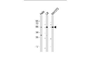 All lanes : Anti-PTEN Antibody (N-term) at 1:500-1:2000 dilution Lane 1: Hela whole cell lysate Lane 2: C6 whole cell lysate Lane 3: NIH/3T3 whole cell lysate Lysates/proteins at 20 μg per lane. (PTEN antibody  (N-Term))