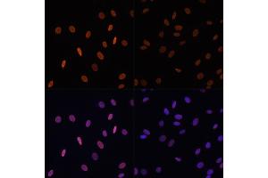 Immunofluorescence analysis of NIH/3T3 cells using Acetyl-Histone H2B-K12 antibody (ABIN7267731) at dilution of 1:100. (Histone H2B antibody  (acLys12))