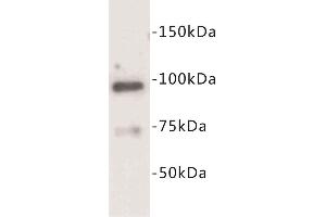 Western Blotting (WB) image for anti-Junctophilin 2 (JPH2) antibody (ABIN1854929) (Junctophilin 2 antibody)