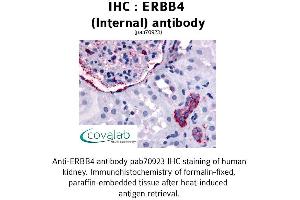 Image no. 1 for anti-V-Erb-A erythroblastic Leukemia Viral Oncogene Homolog 4 (Avian) (ERBB4) (Internal Region) antibody (ABIN1734120) (ERBB4 antibody  (Internal Region))