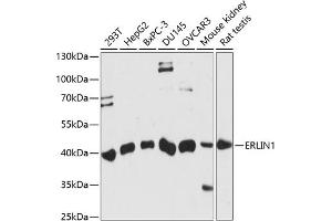 Western blot analysis of extracts of various cell lines, using ERLIN1 antibody (ABIN7267005) at 1:1000 dilution. (ERLIN1 antibody  (AA 259-348))