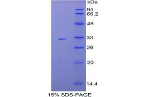 SDS-PAGE analysis of Mouse TBG Protein. (SERPINA7 Protein)