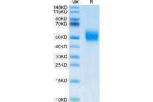 Biotinylated Human FGFR2 beta (IIIb) on Tris-Bis PAGE under reduced condition. (FGFR2 beta (AA 152-378) protein (His-Avi Tag,Biotin))