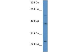 WB Suggested Anti-ACOT9 Antibody Titration: 1. (ACOT9 antibody  (C-Term))