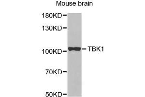 Western blot analysis of extracts of mouse brain, using TBK1 antibody (ABIN1875027) at 1:1000 dilution. (TBK1 antibody)