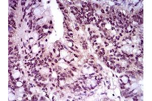 Immunohistochemistry (IHC) image for anti-T Antigen (AA 257-309) antibody (ABIN1098136)