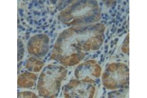 IHC-P analysis of Kidney tissue, with DAB staining. (NUAK1 antibody  (AA 421-658))