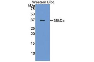 Western Blotting (WB) image for anti-Hydroxysteroid (17-Beta) Dehydrogenase 1 (HSD17B1) (AA 4-289) antibody (ABIN1859203) (HSD17B1 antibody  (AA 4-289))
