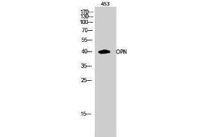 Western Blotting (WB) image for anti-Secreted phosphoprotein 1 (SPP1) (C-Term) antibody (ABIN3176676) (Osteopontin antibody  (C-Term))