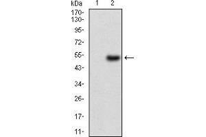 Western blot analysis using WT1 mAb against HEK293 (1) and WT1 (AA: 314-479)-hIgGFc transfected HEK293 (2) cell lysate. (WT1 antibody  (AA 314-479))