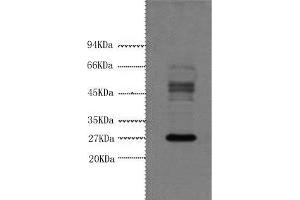 Western Blot analysis of Hela cells using Galectin 3 Monoclonal Antibody at dilution of 1:3000. (Galectin 3 antibody)