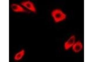Immunofluorescent analysis of RhoC staining in Hela cells. (RHOC antibody)