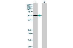 Lane 1: PNLIPRP1 transfected lysate ( 51. (PNLIPRP1 293T Cell Transient Overexpression Lysate(Denatured))