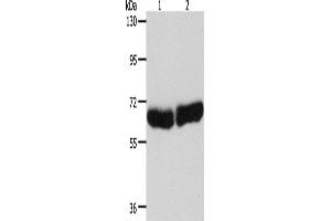 Western Blotting (WB) image for anti-Cytochrome P450, Family 1, Subfamily B, Polypeptide 1 (CYP1B1) antibody (ABIN2428022) (CYP1B1 antibody)