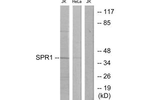 Western blot analysis of extracts from Jurkat cells and HeLa cells, using SPR1 antibody. (SPR1 antibody  (C-Term))