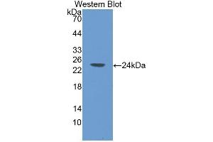 Western Blotting (WB) image for anti-Selectin P (Granule Membrane Protein 140kDa, Antigen CD62) (SELP) (AA 58-259) antibody (ABIN1078522) (P-Selectin antibody  (AA 58-259))