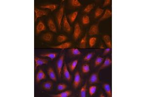 Immunofluorescence analysis of U-2 OS cells using SOCS2 Rabbit mAb (ABIN7270641) at dilution of 1:100 (40x lens). (SOCS2 antibody)