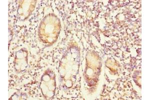 Immunohistochemistry of paraffin-embedded human small intestine tissue using ABIN7152363 at dilution of 1:100 (EYA3 antibody  (AA 1-300))