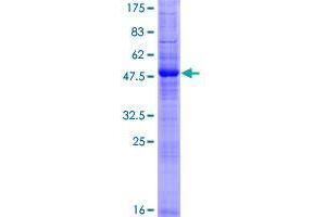 Image no. 1 for Ring Finger Protein 186 (RNF186) (AA 1-227) protein (GST tag) (ABIN1318323) (RNF186 Protein (AA 1-227) (GST tag))