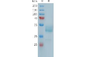Human F(752-834) Protein, mFc Tag on SDS-PAGE under reducing condition. (FCRL5 Protein (AA 752-834) (mFc Tag))