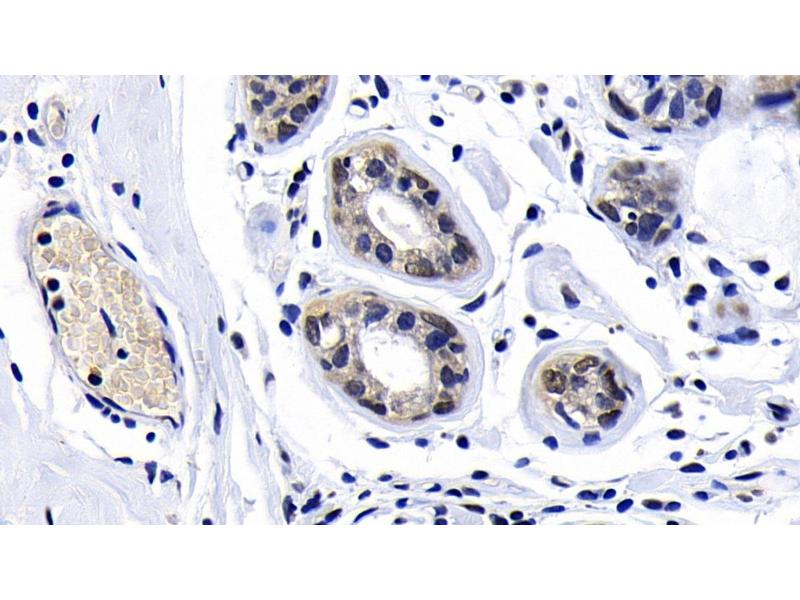 ATM Antibody (ABIN7433537)