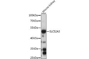 Western blot analysis of extracts of mouse kidney, using SLC52 antibody (ABIN7270472) at 1:1000 dilution. (Solute Carrier Family 52 (Riboflavin Transporter), Member 3 (SLC52A3) (AA 200-300) antibody)