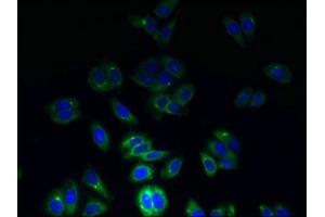 Immunofluorescent analysis of HepG2 cells using ABIN7171887 at dilution of 1:100 and Alexa Fluor 488-congugated AffiniPure Goat Anti-Rabbit IgG(H+L) (Tetraspanin 7 antibody  (AA 113-223))